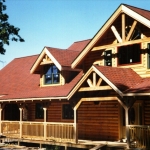 Shingles On